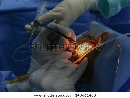 surgeons holding medical instruments and eye operate,Eye Surgery