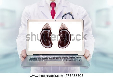Doctor with stethoscope in a hospital. Kidneys on the laptop monitor. High resolution.