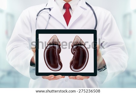 Doctor with stethoscope in a hospital. Kidneys on the tablet. High resolution.