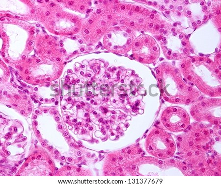 Renal corpuscle seen under a light microscope.  The Bowman capsule and the glomerular capillaries are clearly seen. Outside the glomerulus, sections of convoluted tubules are distinguished