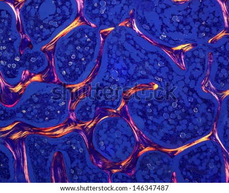 Trabecular or spongy bone as seen under a polarized light microscope. The bone trabeculae show bright and dark bone lamellae due to the orientation of its collagen fibers.