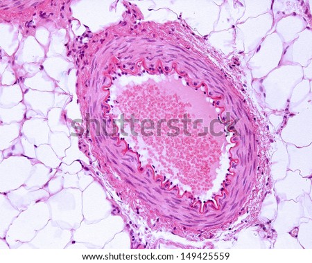 Microscope image of a muscular artery stained with hematoxylin-eosin. A prominent internal elastic lamina intima is located between tunica intima and tunica media, wich shows smooth muscle fibers.