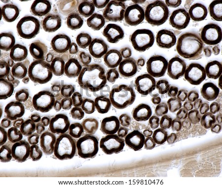 Myelin sheath of peripheral nerve fibers stained with osmium tetroxyde. Light microscope micrograph.