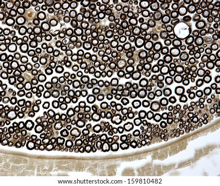 Cross section of a myelinated nerve stained with osmium tetroxyde to show the myelin sheath of nerve fibers. Light microscope micrograph.