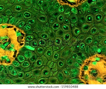 Light microscope micrograph showing desmosomes in a stratum spinosum of the epidermis. The microscopical image has been filtered to highlight the desmosomes.