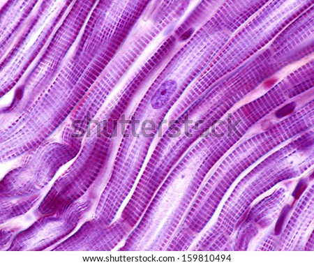 Striated muscle fibers of the heart myocardium. The cardiac myocytes have a central  single nucleus and peripheral myofibrils. Light microscope micrograph.