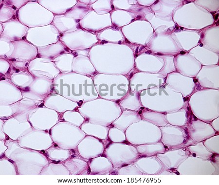Light micrograph of white adipose tissue stained with hematoxylin and eosin. Adipocytes (fat cells) contains a large lipid droplet.