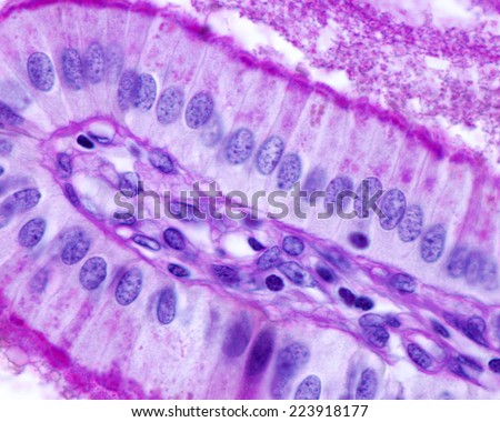Simple columnar epithelium of gallbladder stained with PAS method. The striated border, basement membrane, and cytoplasmic granules are PAS +. Light microscope picture
