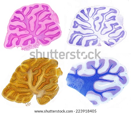 Four cerebellum sections stained with H&E (top right), cresyl violet (top right), silver nitrate method for nerve fibers (bottom left) and Kluver-Barrera technique for myelinated fibers (bottom right)