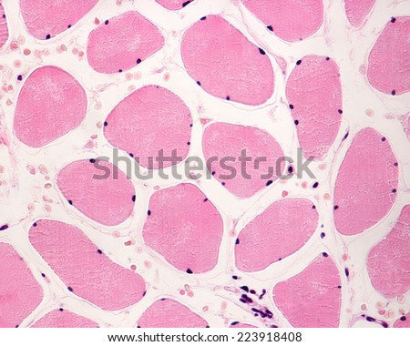Skeletal striated muscle fibers in cross section showing the presence of several nuclei (multinucleated cells) located in the cell periphery. Light microscope photomicrograph