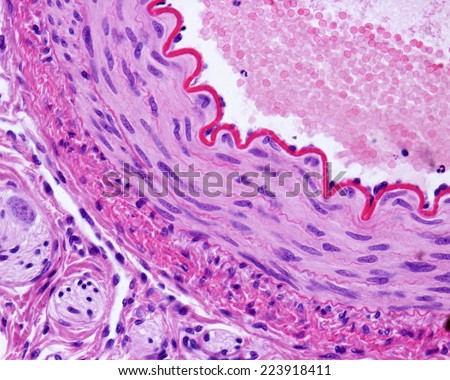 Light micrograph of a cross-sectioned muscular artery, showing a thick and wavy internal elastic lamina, a middle layer with smooth muscle fibers, and an outer connective tissue adventitia. H&E stain