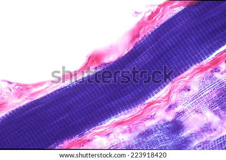 Striated skeletal muscle fiber showing the cross-striation with dark A bands and light I bands. High magnification light micrograph