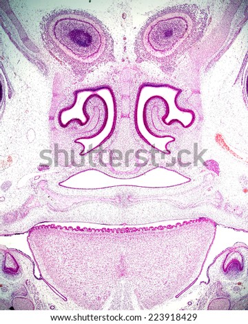 Frontal section of the head of an embryo showing, from top to bottom, the olfactory bulbs, nasal cavities with the turbinates, and the oral cavity with the tongue in the middle and two teeth buds