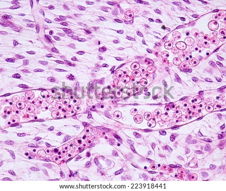 Blood vessels in embryonic tissue. The vessels are lined by endothelium (simple squamous epithelium) and contain inside immature nucleated red blood cells. Light microscope micrograph. H&E stain