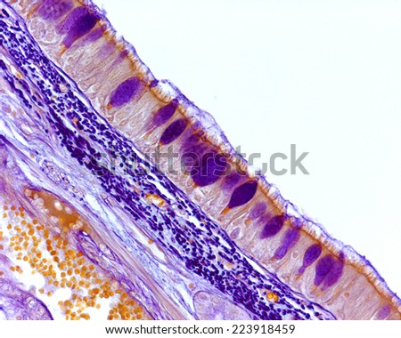 Tracheal mucosa lined by ciliated pseudostratified prismatic epithelium with goblet cells stained in purple as well as the elastic fibers located under the epithelium. Light microscope picture