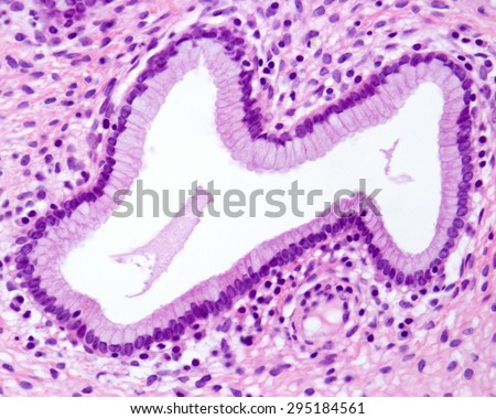 Endocervical gland lined by a simple columnar epithelium formed by mucous-secreting cells. Light microscope picture. H&E stain