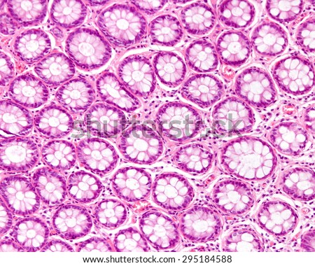 Cross section of intestinal glands (LieberkÃ?Â¼hnÃ¢Â?Â?s crypts) showing mucous goblet cells.