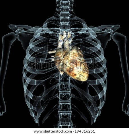 An x-ray of a human chest with a brown organ in the center.