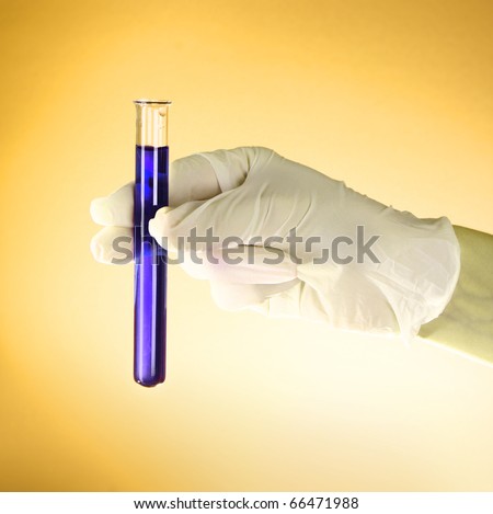 Test tube with liquid in the doctor\'s hand on the yellow background
