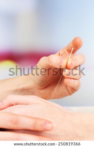 Acupuncture on hand, close up. Isolated on white