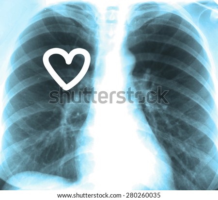 Human x-ray with heart, close-up