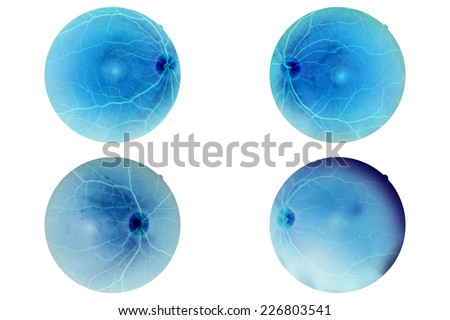 Human eye anatomy, retina, optic disc artery and vein etc.