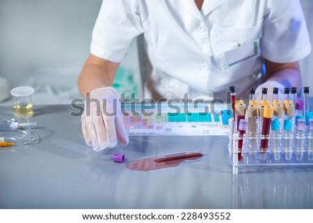 Accidents in the laboratory. Scientists spilled test tube with infected blood