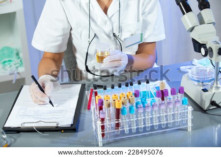 A woman wearing white coat and white medical gloves holding a urine sample in his hand