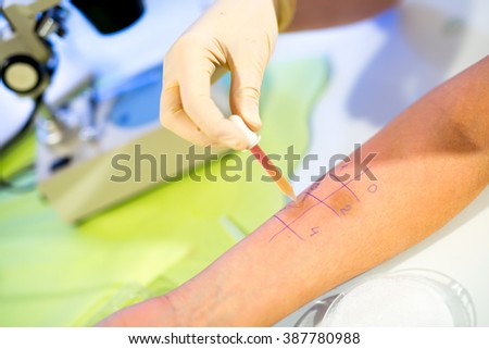 Skin prick allergy to find out kind of allergy