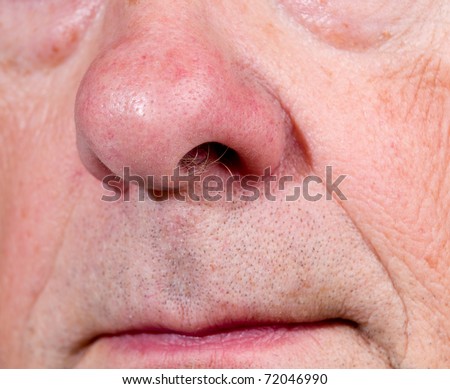 Front view of mature man\'s nose and upper lip with the mouth just visible