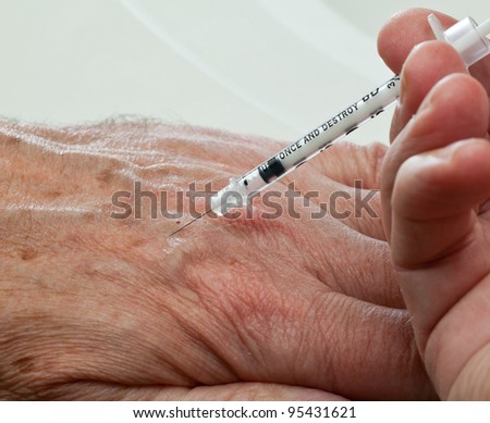 Injection into vein of senior man hand from small hypodermic needle