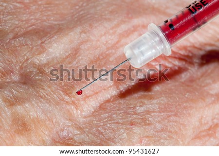 Injection into vein of senior man hand from small hypodermic needle