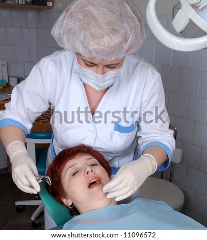 doctor extract a tooth from woman