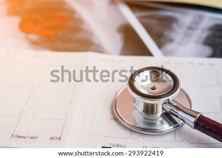Stethoscope on X-ray paper report, medical Concept