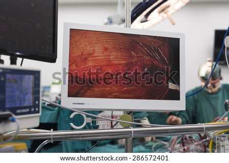behind monitor at heart bypass machine station