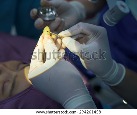 doctor prepare silicone for chin augmentation