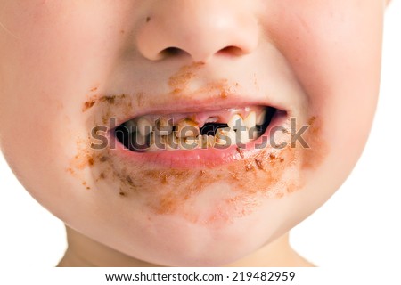 the child with a dirty mouth and missing tooth