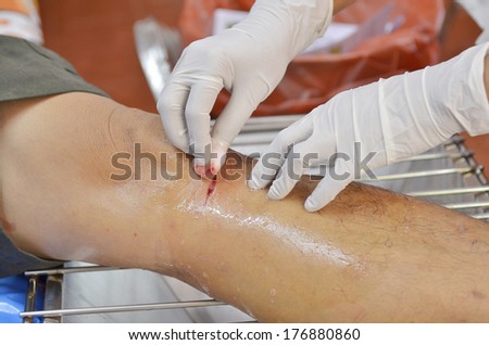 doctor scrubs cut wound.