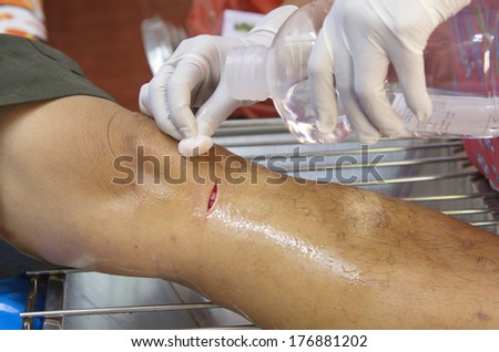 doctor scrubs cut wound.