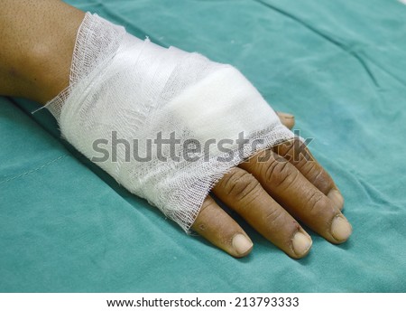 hand covered with a simple gauze dressing.