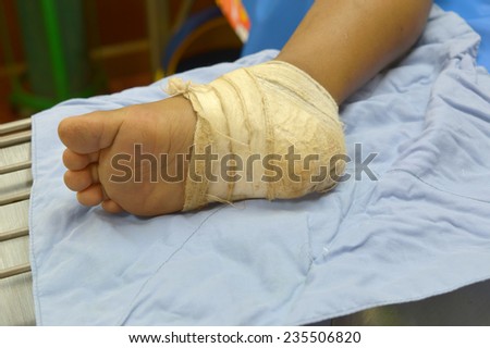 bandage on injury foot.