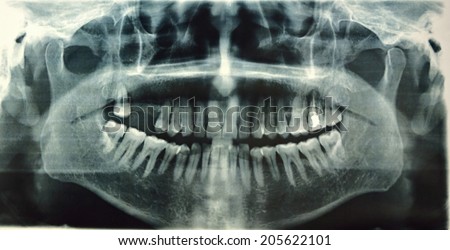 The oral cavity teeth panoramic radiograph
