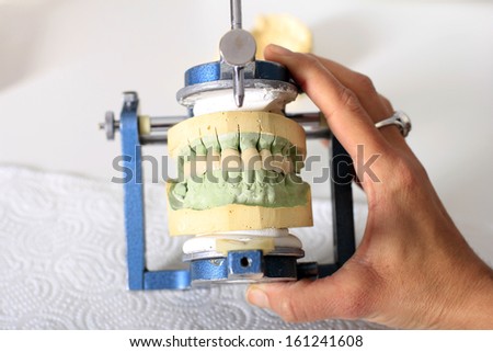 dental technician completes the process of making ceramic teeth in dental lab. Glaze.
