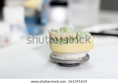 Ceramic crown on gypsum model in dental laboratory