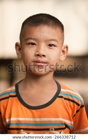 boy with scars from chicken pox