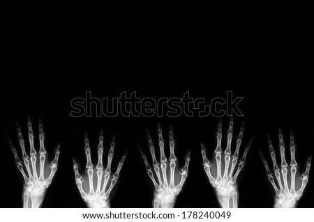 Hand X-ray background