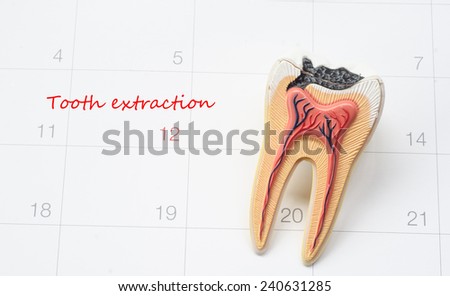A note of a dentist appointment on a calendar, Tooth extraction