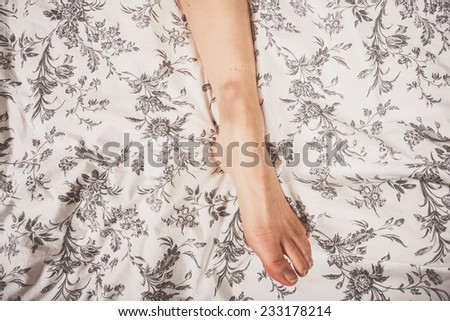 A young woman\'s bruised leg as she is lying in bed