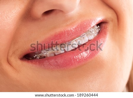 Beautiful smiling mouth with teeth