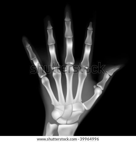 x ray hand. vector : vector x-ray hand